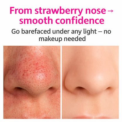 EverSmooth PoreLift™